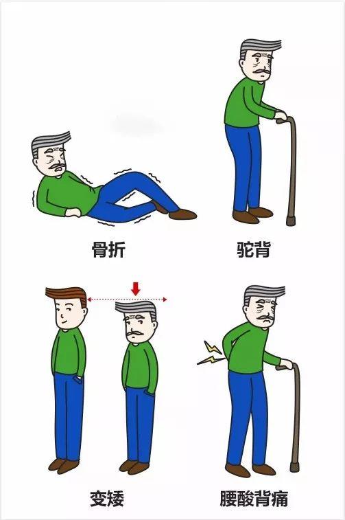 超聲骨密度儀檢測 超聲骨密度儀檢測