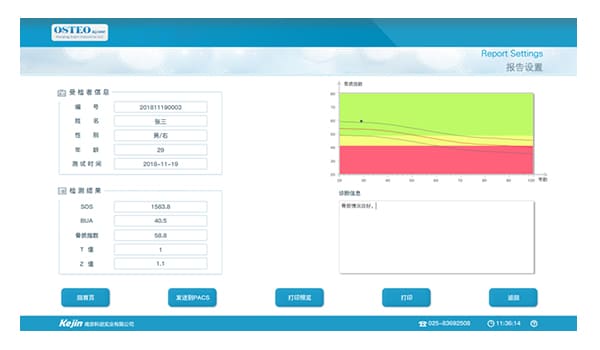 超聲骨密度儀檢測