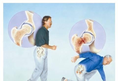 骨密度檢測(cè)儀