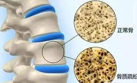 骨密度儀生產廠家 骨密度儀生產廠家